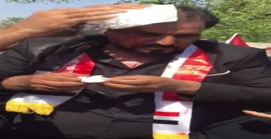 الكوادر الادارية في صحة ذي قار تعلن الاضراب بعد الاعتداء على مديرها 