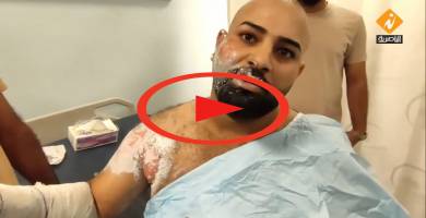 تلفزيون الناصرية: محتجون يتحدثون من داخل المستشفى عن الحريق الذي تعرضوا له صباح اليوم